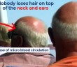 hair-fall-treatment